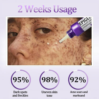 Final 3 Hours: 60%OFF🔥Vaxflite™ Retinol Radiance Cream