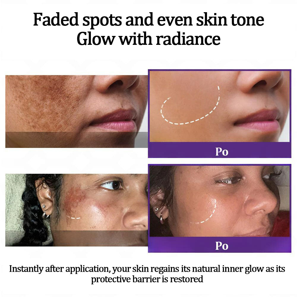 Final 3 Hours: 60%OFF🔥Vaxflite™ Retinol Radiance Cream